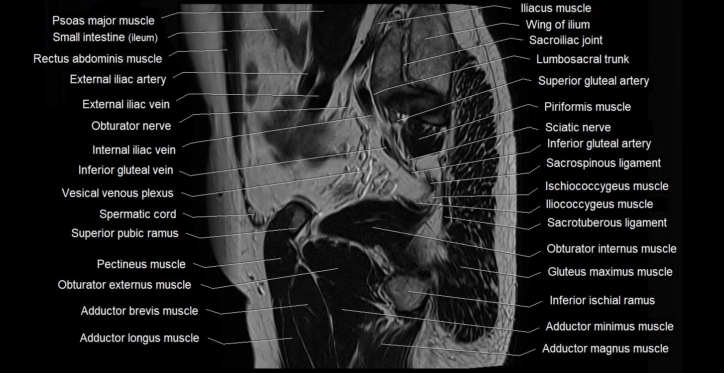 male pelvis sagittal cross sectional anatomy 3T mri image 36.webp